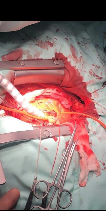 76914833 853954165055380 4674264946060558336 n