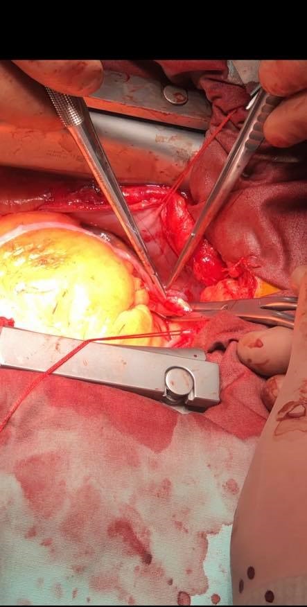 77398665 853953808388749 1150202803193380864 n